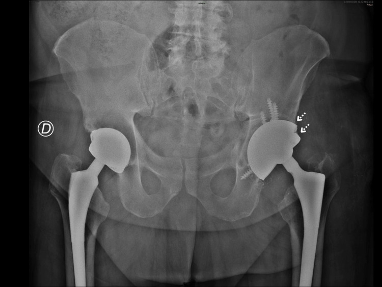 Figure 6