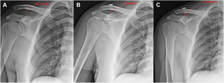 Figure 9