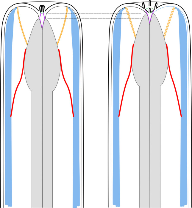 Figure 22