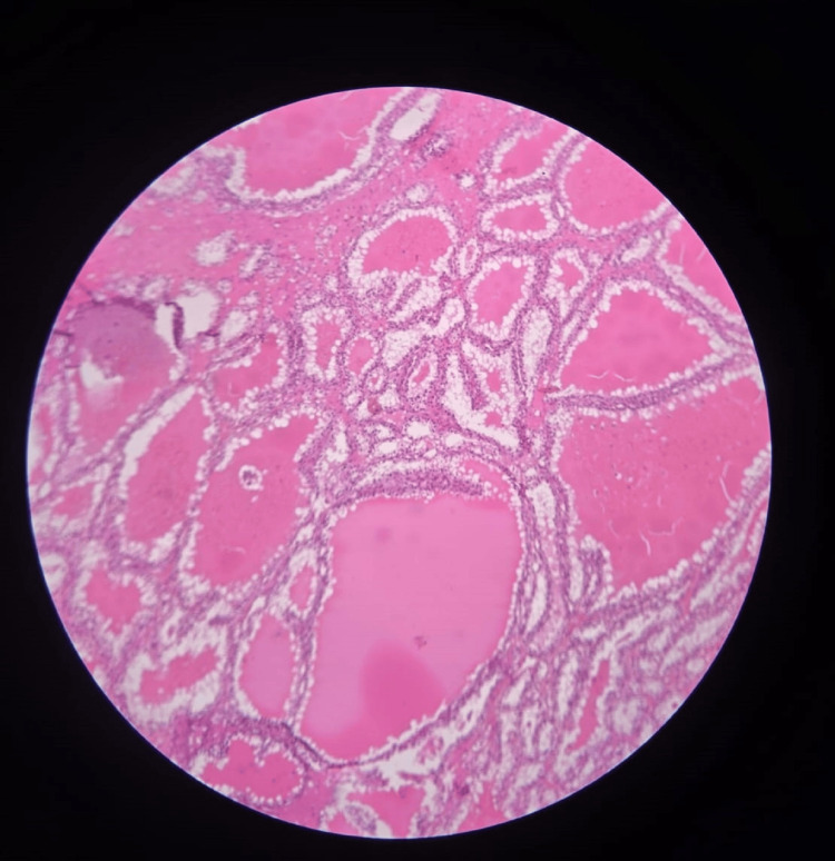 Figure 11