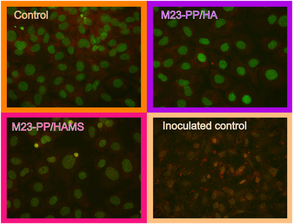 Figure 12