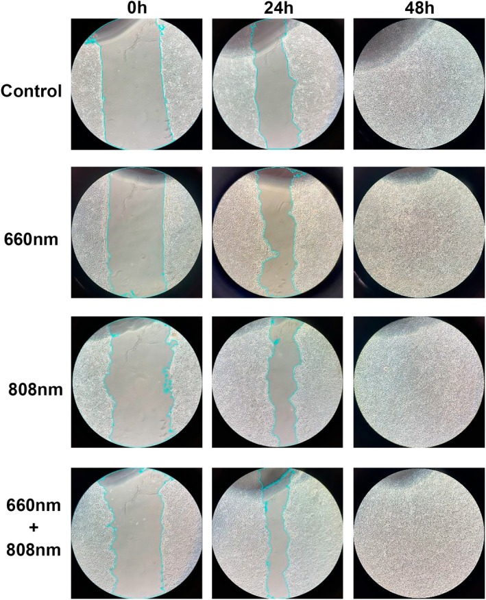 FIGURE 3