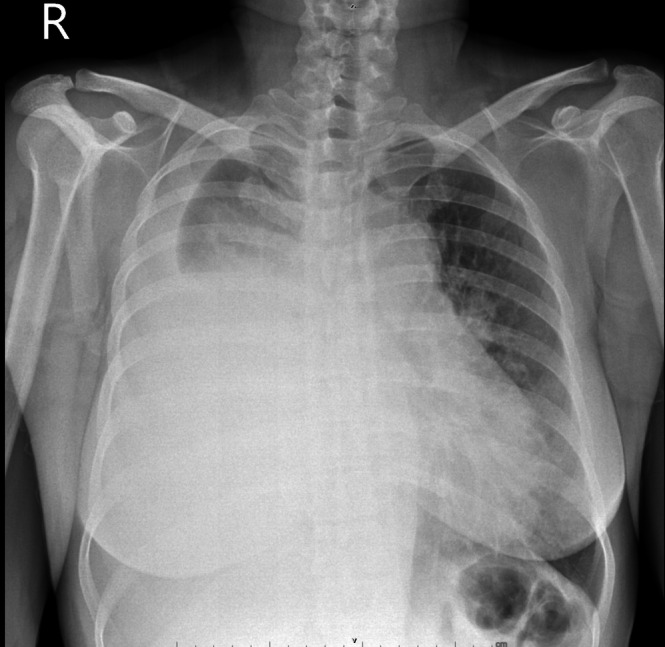 FIGURE 1