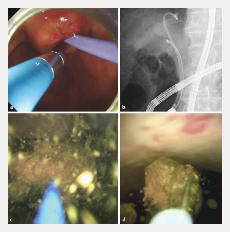 Fig. 4