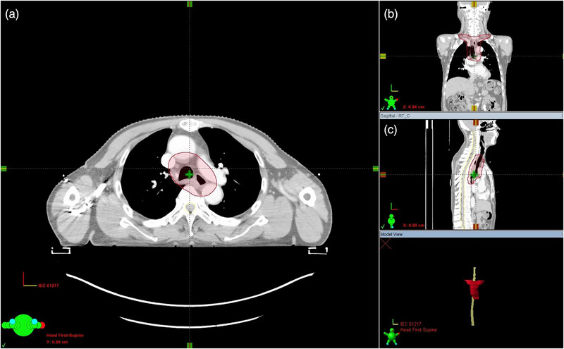FIGURE 1