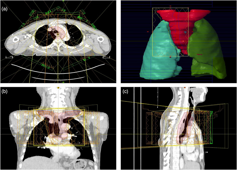 FIGURE 2
