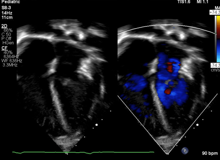 Figure 4