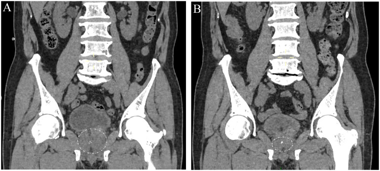 Figure 2