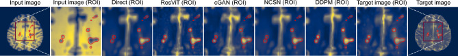 Figure 11