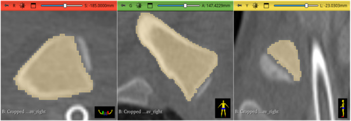 Figure 6