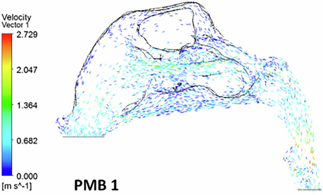 Figure 12