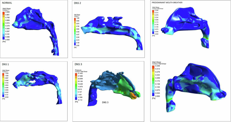 Figure 14