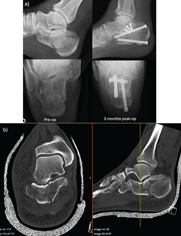 Figure 4