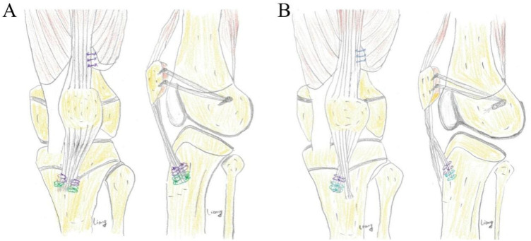 Figure 1