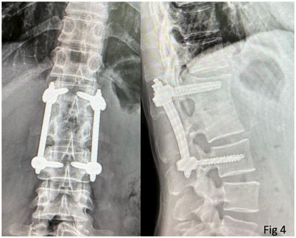 Figure 4