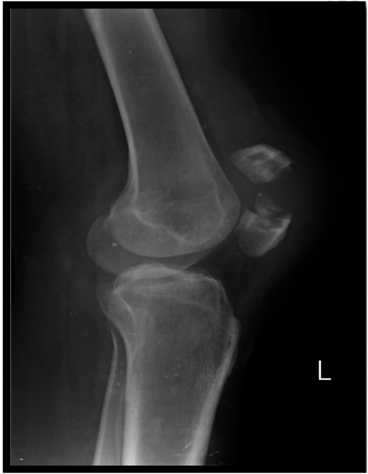 Figure 1