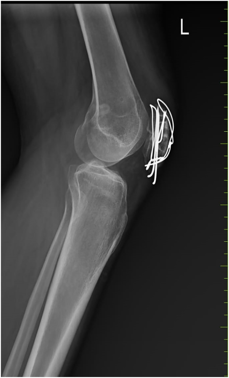 Figure 2