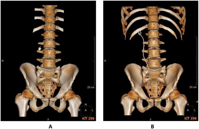Figure 3