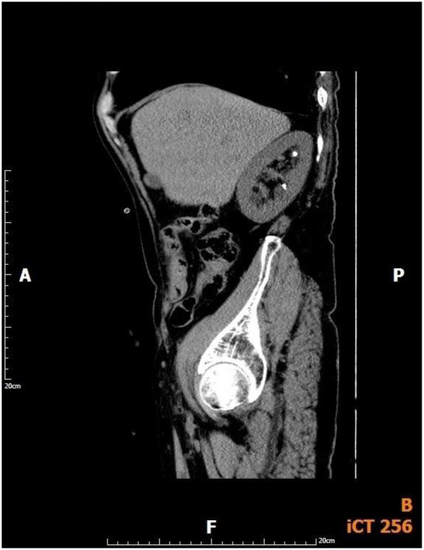 Figure 4