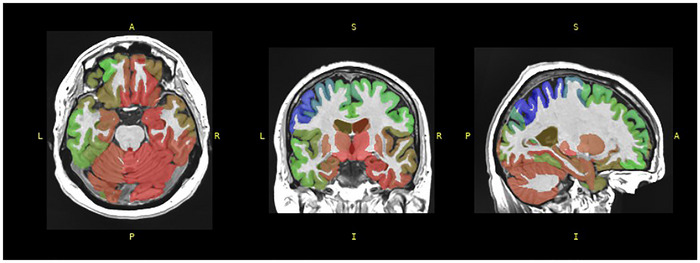 FIGURE 1