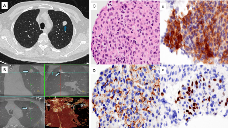 Figure 6