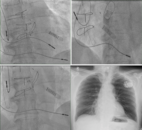 Figure 6