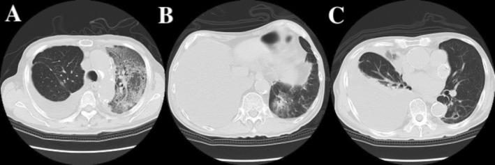 FIGURE 2