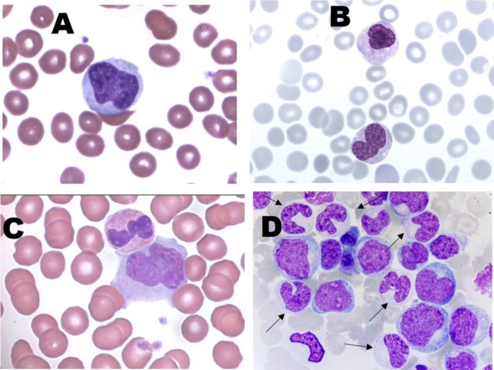 FIGURE 4