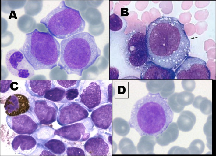FIGURE 1