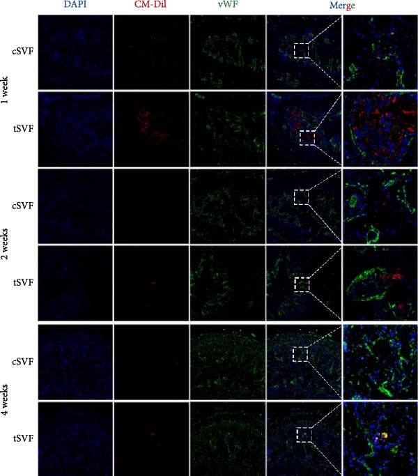 Figure 35