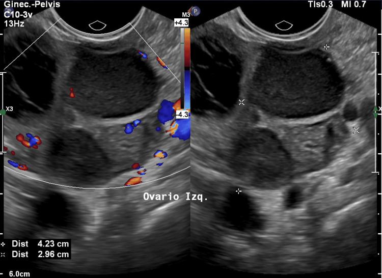 Figure 2