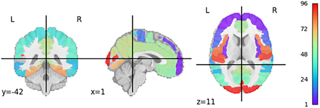 Figure 41
