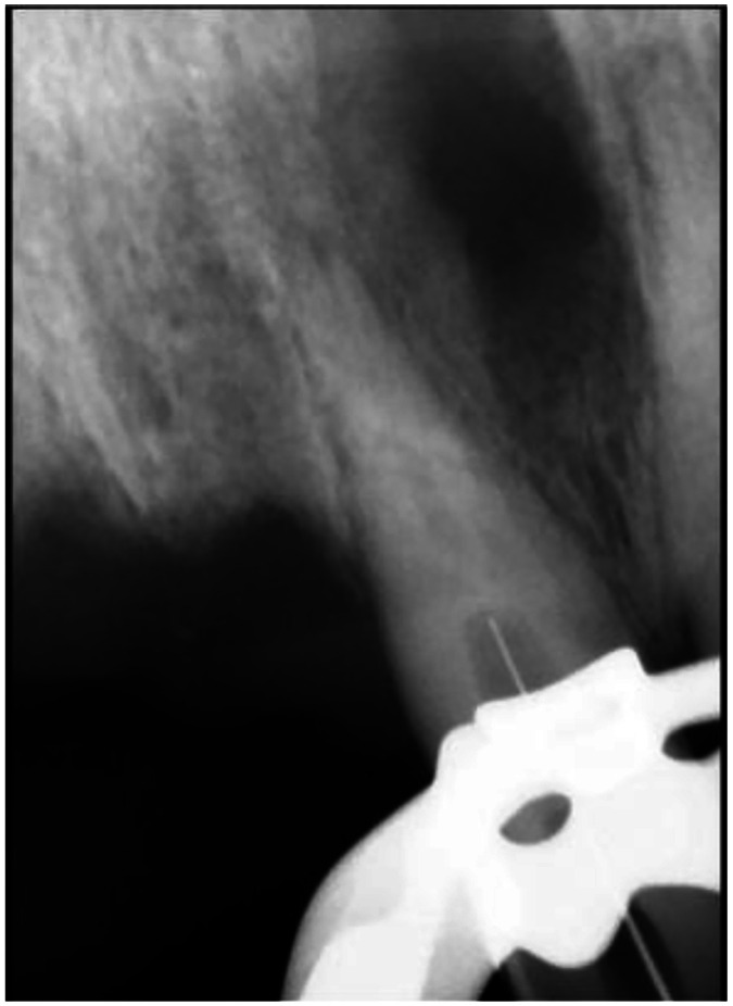 Figure 11