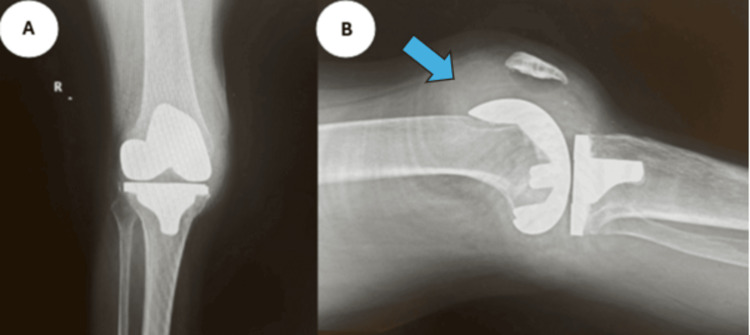 Figure 8