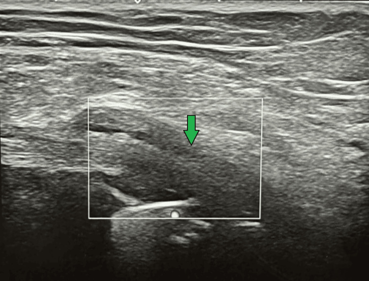Figure 9