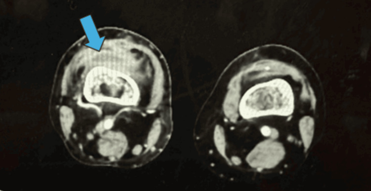 Figure 10