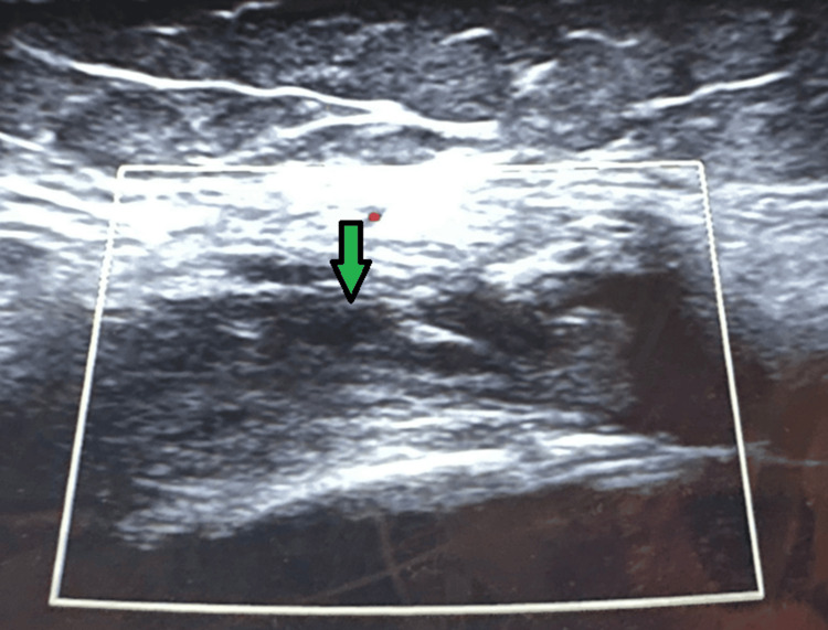 Figure 12