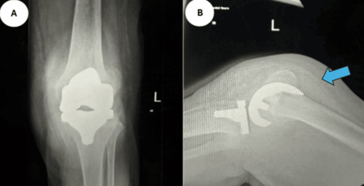 Figure 13