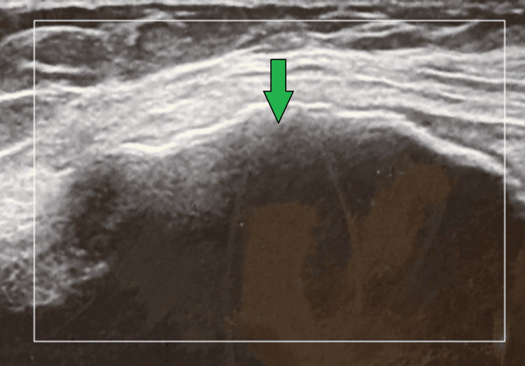Figure 14