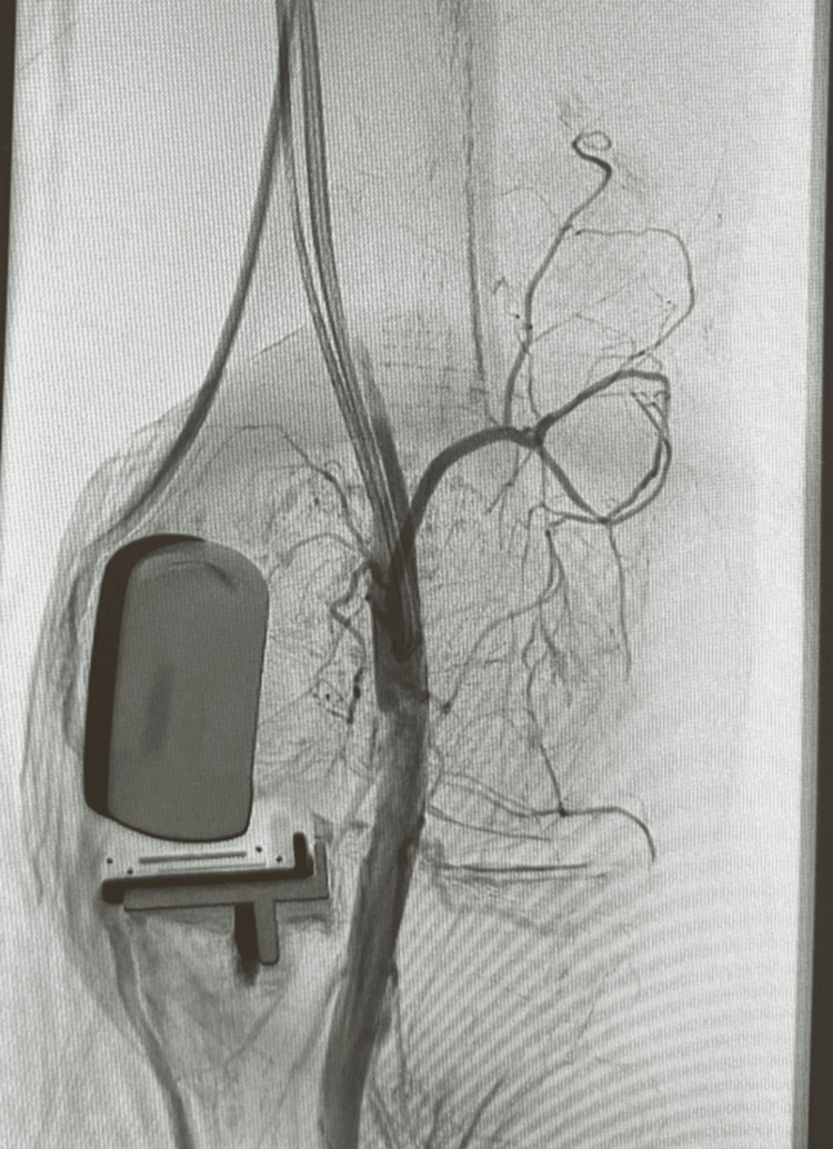Figure 16