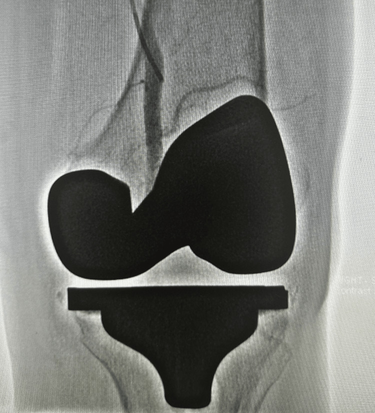 Figure 17