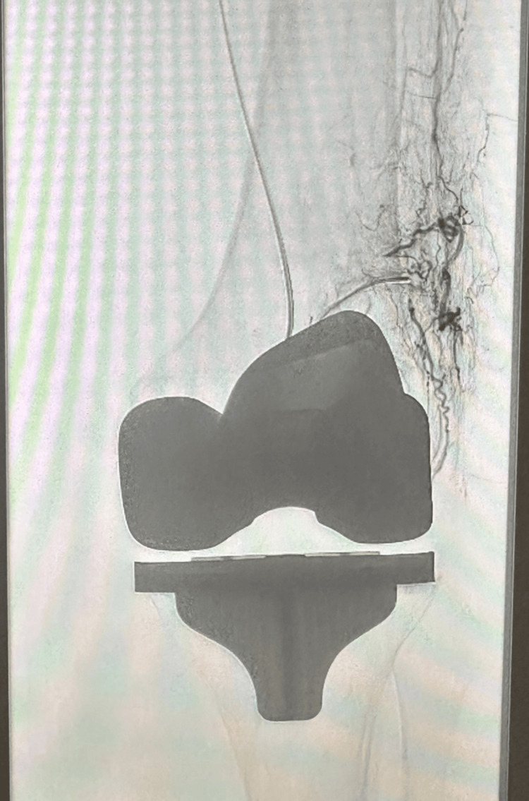 Figure 18