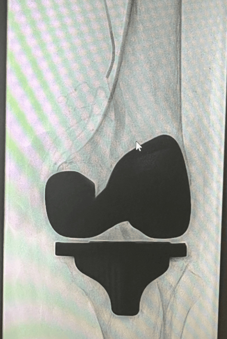 Figure 19