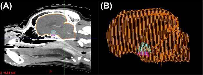 FIGURE 3