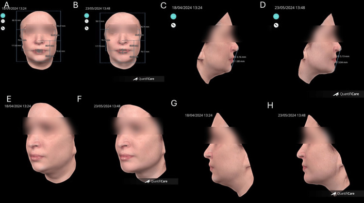 Figure 11
