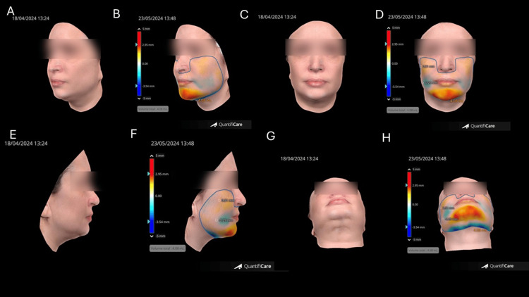 Figure 12