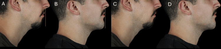 Figure 14