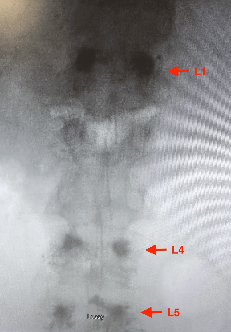 Figure 5