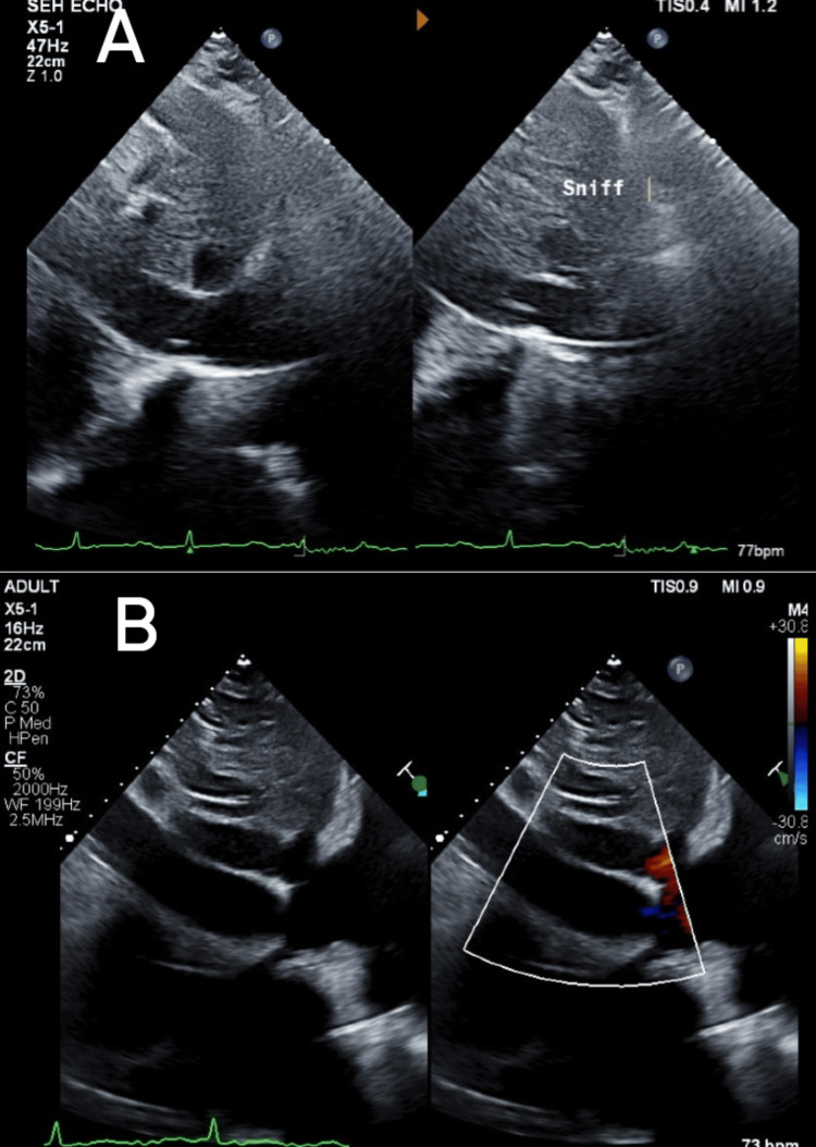 Figure 5