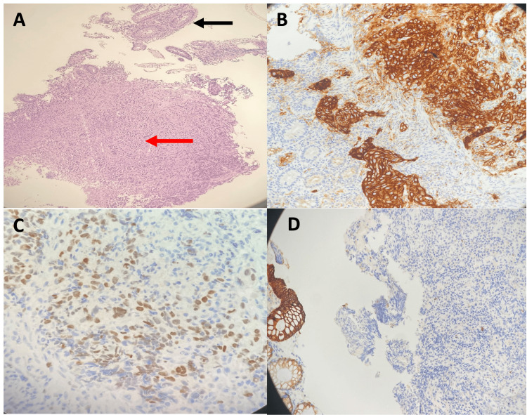 Figure 11
